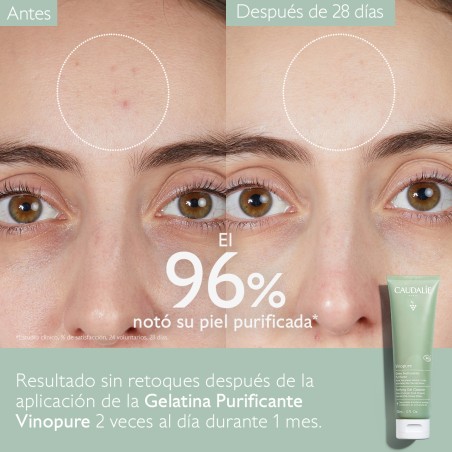 CAUDALIE VINOPURE GELATINA LIMPIADORA PURIFICANTE. 150 ML.